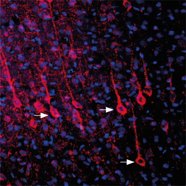 Survivin (pThr34)Nanobody